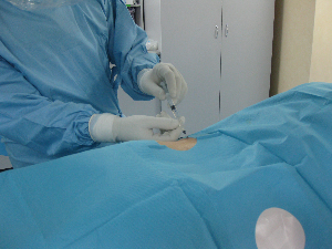 Discoplasty with Discogel